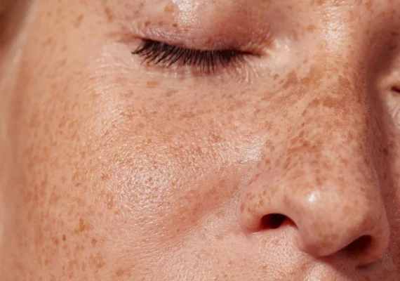 Beauty Heaven Microneedling